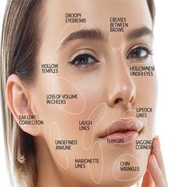 What are fillers used for?