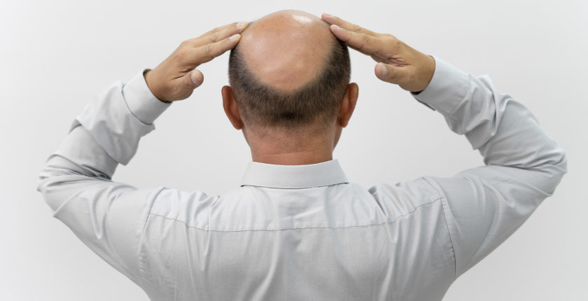 What causes hair loss in teenage males  SkinQure