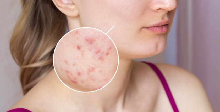 COMMON SKIN ISSUES AND HOW TO TREAT THEM