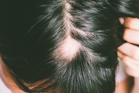 Dr. Donovan's Hair Loss Articles (2011-2024) — Donovan Hair Clinic