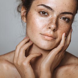 melasma/when-to-expect-results