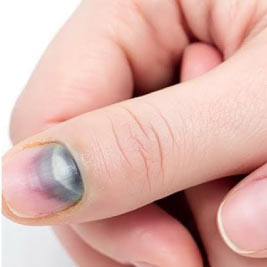 abnormal nail coloration