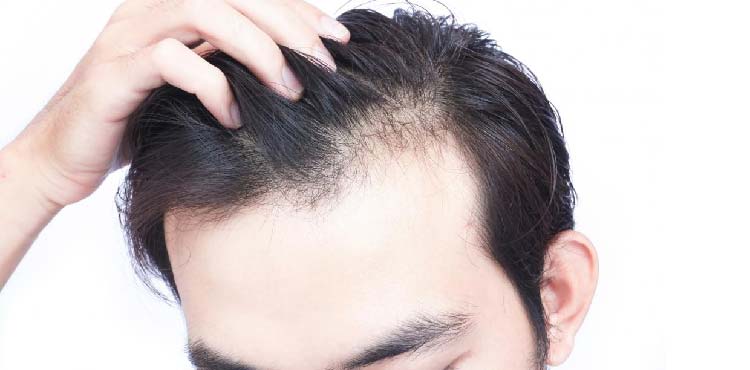Best Clinic for Hair Loss Treatment in Bangalore | Hair Loss Treatment