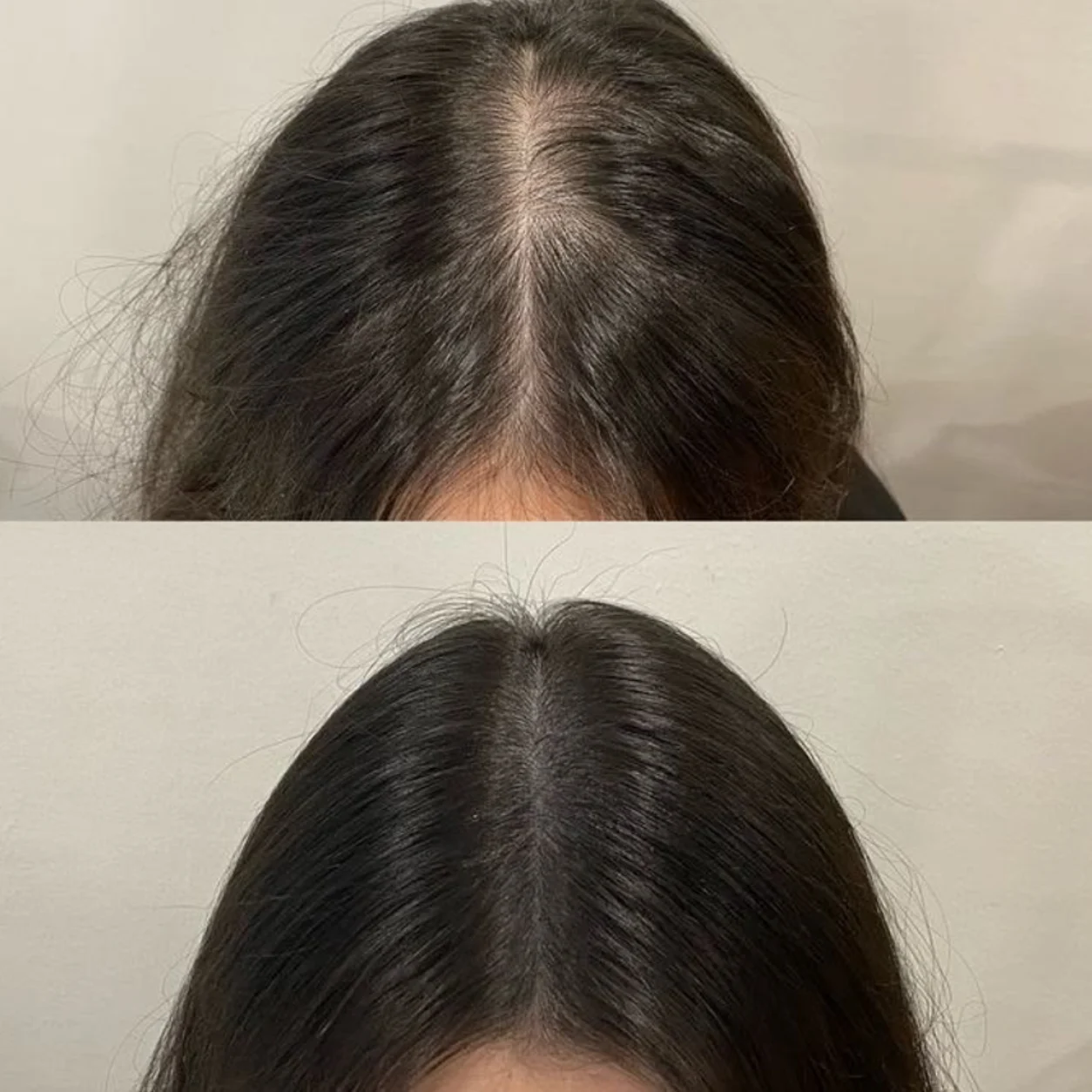 hair